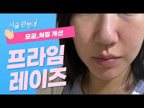 모공처짐 해결 방안 레츠고