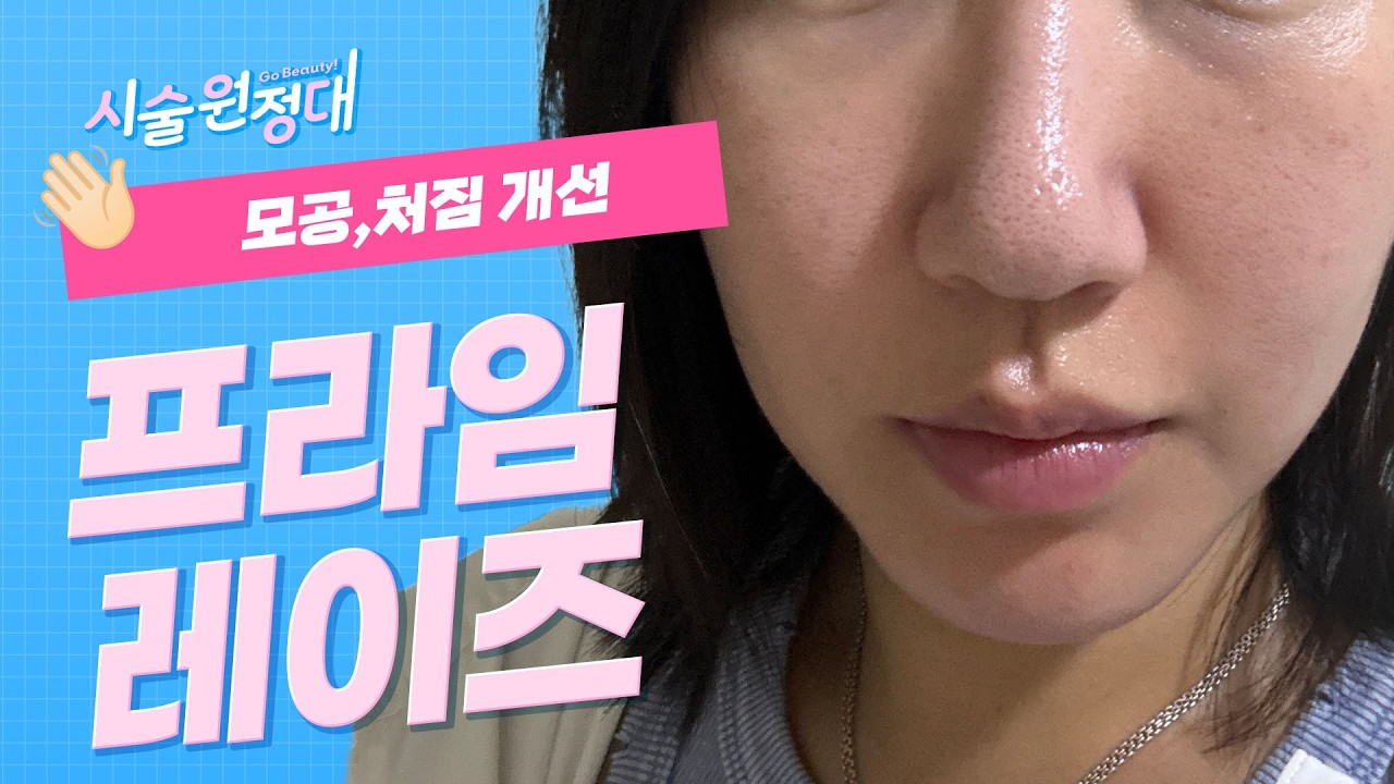 related_video_thumbnail