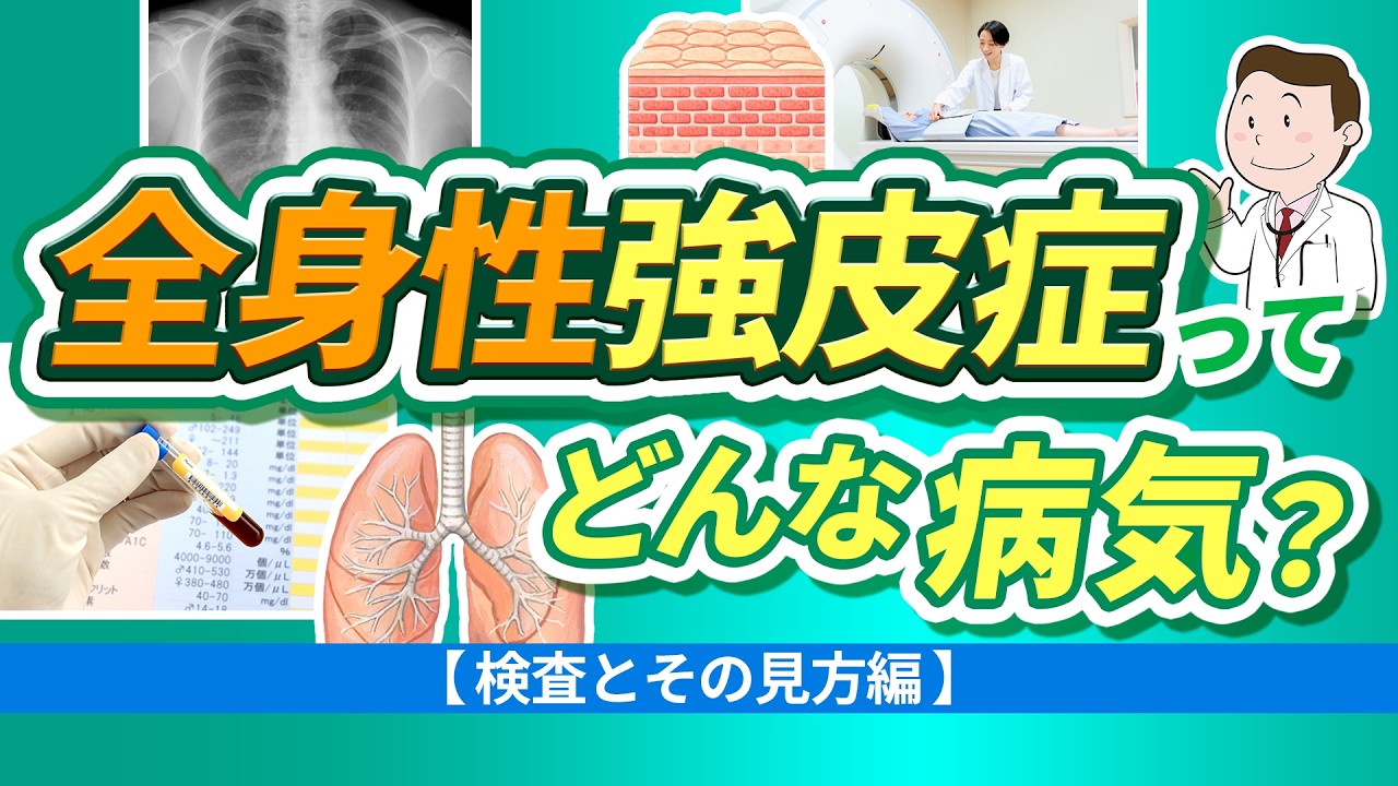 全身性強皮症ってどんな病気？【検査とその見方編】【医師解説】