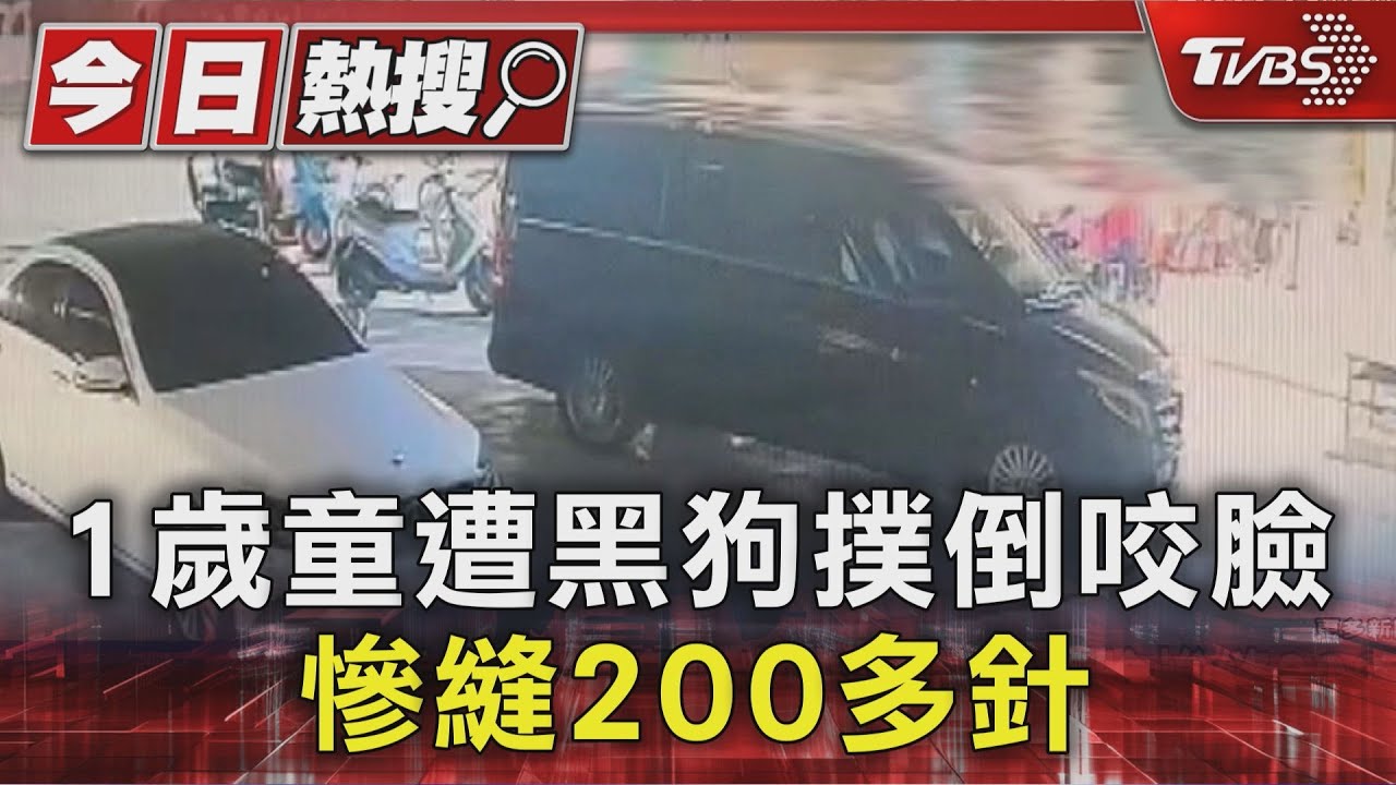 平安宴吃席！　1歲童遭黑狗撲倒咬臉　慘縫200多針