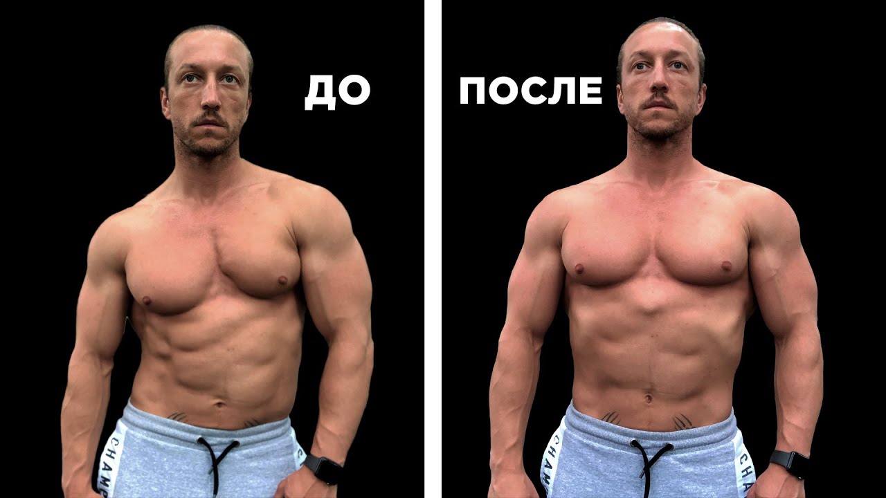 Сколиоз можно исправить! Иван Красавин