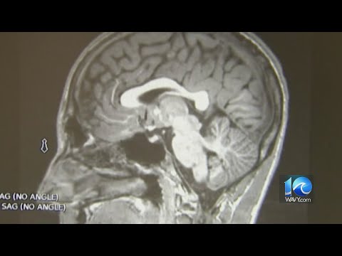 Chronic constipation may lead to dementia