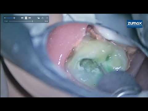 서울이로운치과 Clips