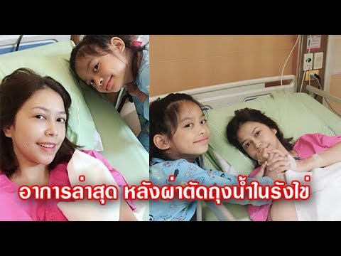 หลังการผ่าตัดเต้านมเพื่อลด เพิ่มหน้าอกราคา Stavropol