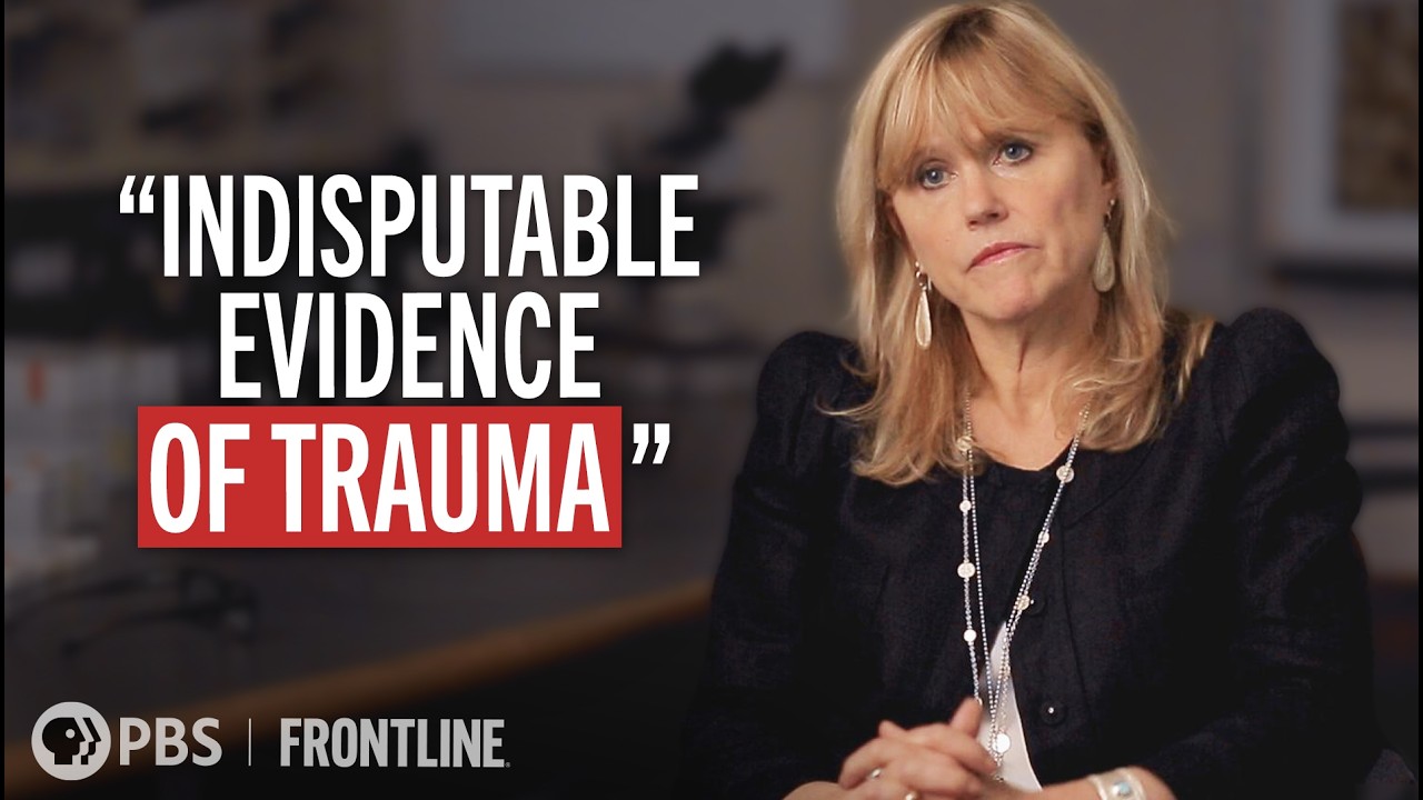 A neurologist on facing doubters of football’s trauma to the brain