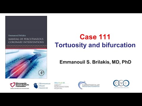 Case 111: PCI Manual - Tortuosity and bifurcation