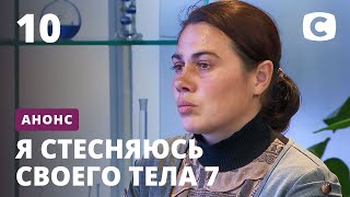 Таких детей лечат бесплатно! ‒ Я стесняюсь своего тела 2020. Смотрите 29 ноября на СТБ!