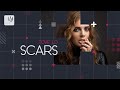 Tove Lo - Scars (Lyric Video)