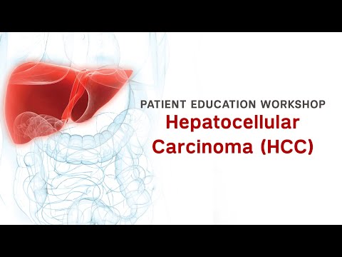 Workshop | Hepatocellular Carcinoma (HCC)