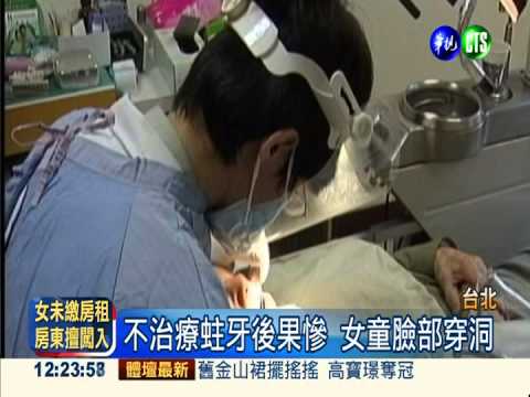 婦蛀牙不敢就醫 引發鼻竇炎.弱視