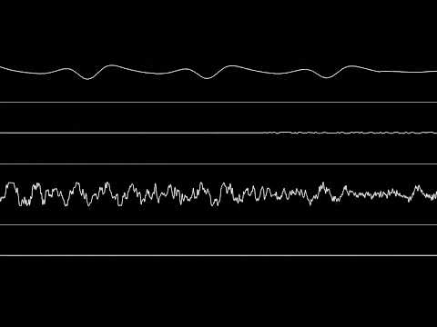 Snow Bros. (Amiga) - Ocean Loader (Spotlight) [Oscilloscope View]