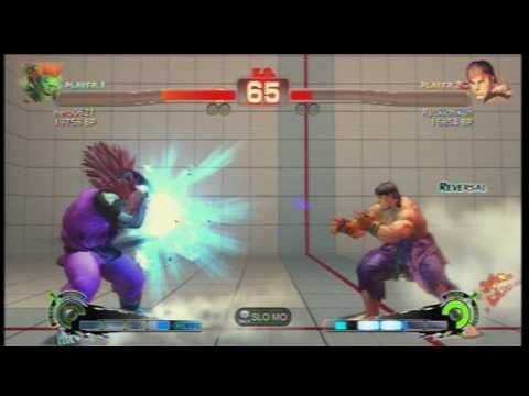 SSF4 [A vs A]: hero0621(#8 Blanka) vs Ryukichikun(#29 Ryu) Ep.32