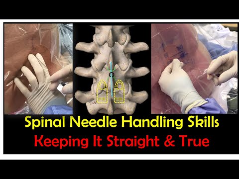 Needle Handling Skills for Successful Lumbar Puncture / Spinal Anesthesia