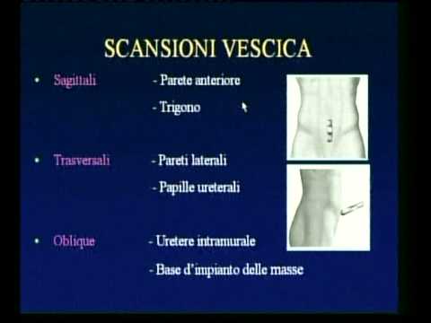 La prostata negli uomini di diagnosi Dispositivo magnete per prostatite