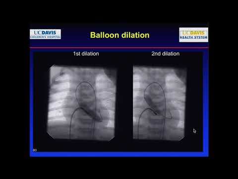 Complications in the cath lab Part2 : Interventions