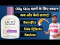 Lacto Calamine Face Lotion Lacto Calamine Face Lotion How To Use Lacto Calamine Lotion Review