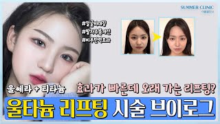 효과가 빠른데 오래가는 리프팅?? | 울타늄 시술 브이로그