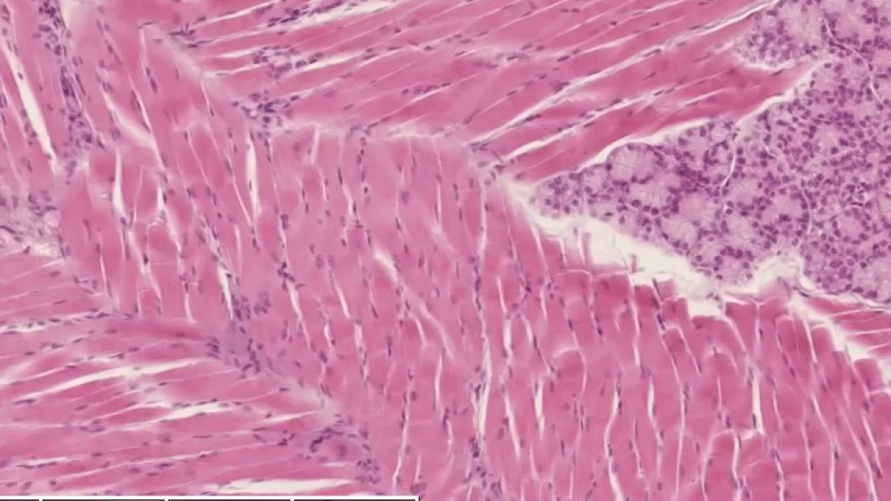 Skeletal Muscle — Histology Video Lesson