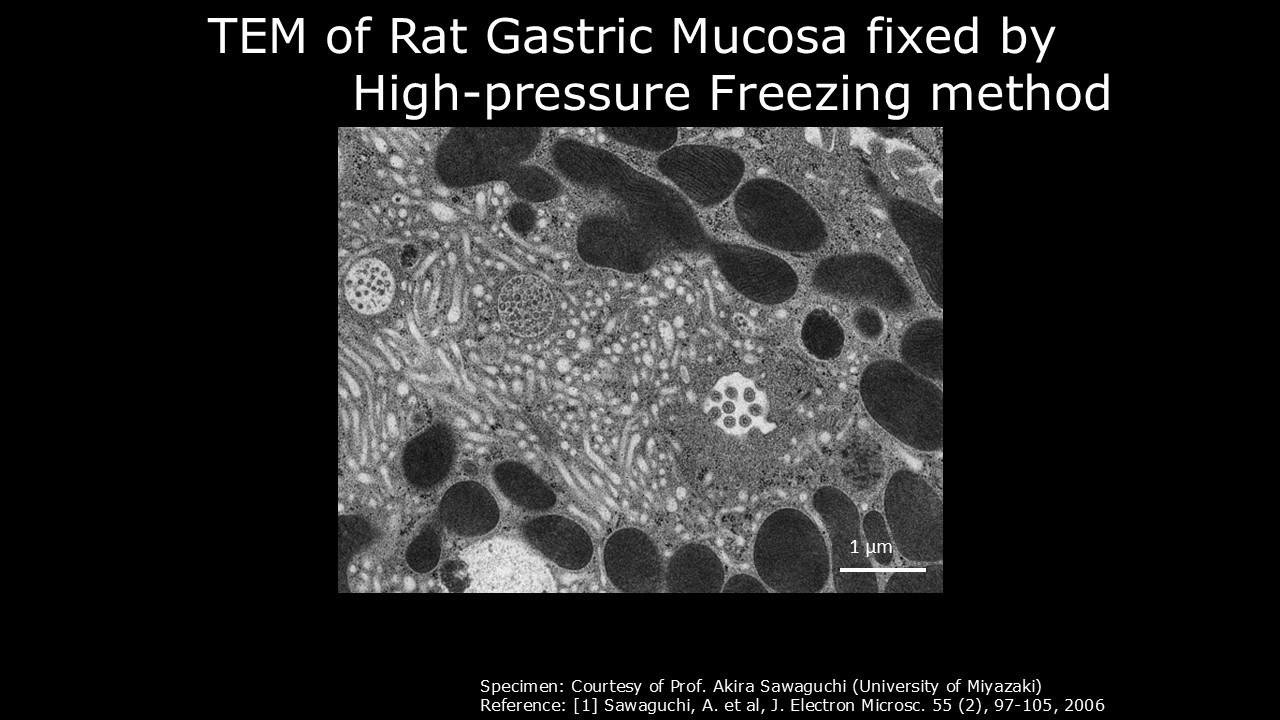 [Life] TEM of Rat Gastric Mucosa fixed by High-pressure Freezing method