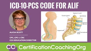 ICD-10-PCS Code for ALIF (Anterior Lumbar Interbody Fusion Procedure)