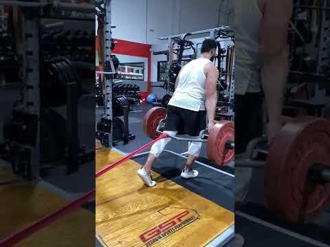Knees Over Toes with Force Vectors Matching on Trap Bar Sprinter Split Squat Lunge with Band Tension