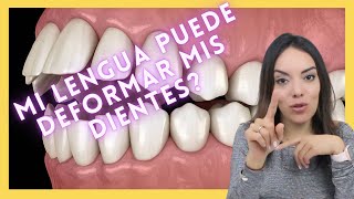 Hábito de Lengua y como evitar DEFORMACIONES