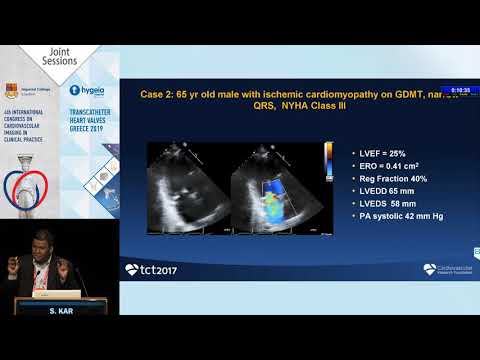 S. Kar | Mitraclip for Functional Mitral Regurgitation