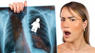Strange Things Found Inside People