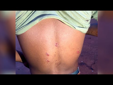 Pelea entre hermanos dejó un herido y dos detenidos en Natalio