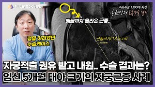어려웠던 자궁근종 로봇수술 케이스🥲 무려 13cm 이상, 5개월 된 태아와 비슷한 크기의  큰 근종과 근종으로 가득 차 있던 자궁은 어떻게 됐을까요?