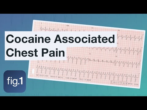 How does cocaine cause acute coronary symptoms?