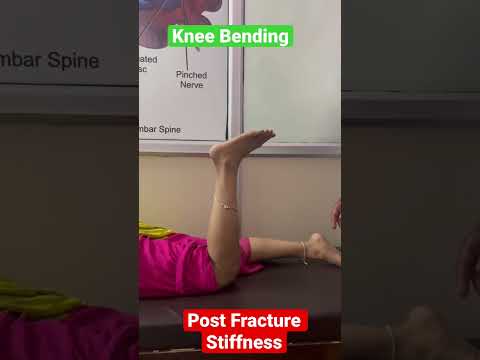 Knee Bending Exercise | Post Fracture Stiffness | Dr. Arvind Jaga #physiotherapy #physiotherapist