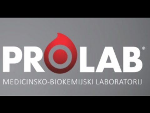 [UŽIVO]  SPARS-TOFAŠ - U16