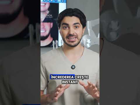 5 beneficii ale danturii fixe