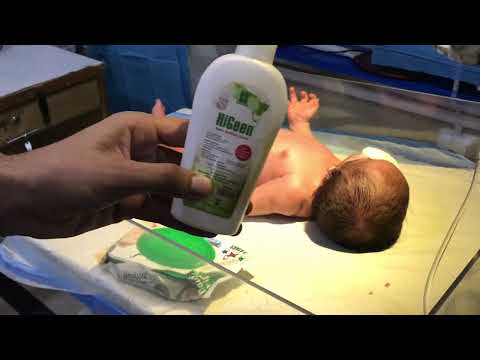 👶 Baby with Abdominal Distension | Glycerin Suppository for Relief 🍼