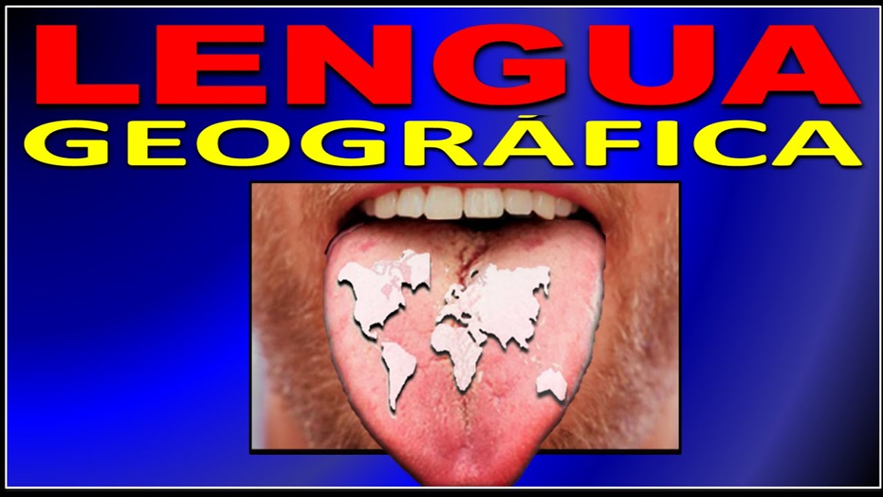 GLOSITIS MIGRATORIA BENIGNA (LENGUA GEOGRÁFICA, ESTOMATITIS O ERITEMA AREATA MIGRANS)