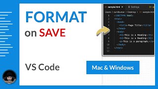 How to enable auto format on save with prettier in VS Code editor - Mac &amp; Windows