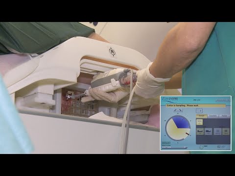 VAB - Tomosynthesis guide Clinical Case - EnCor & Affirm – BD Europe