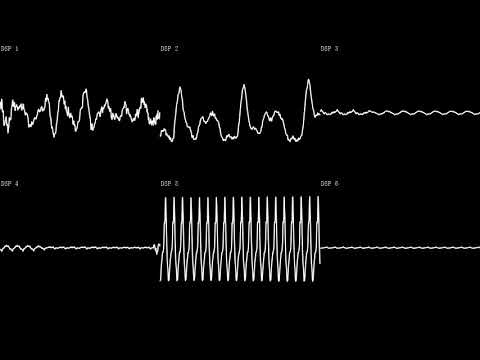 [SPC700] Ganso Pachinko Ou - Seaside (Arrangement)
