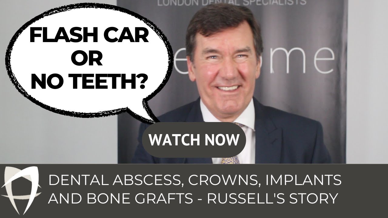 Russell - 3 Implants (UR3, LR6, LL6) + Post Core & Crown + Pocket Reduction Surgery