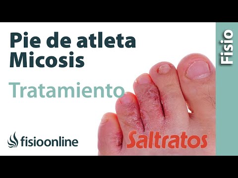 Del hongo de los pies que ungüentos ayudan a Como curar el hongo de la piel a los niños