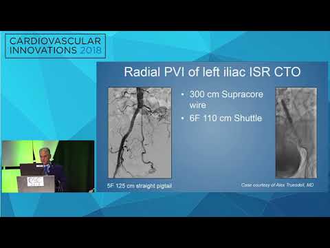 CVI2018 Session: Access site selection, retrograde, brachial, radial - Peter Soukas, MD