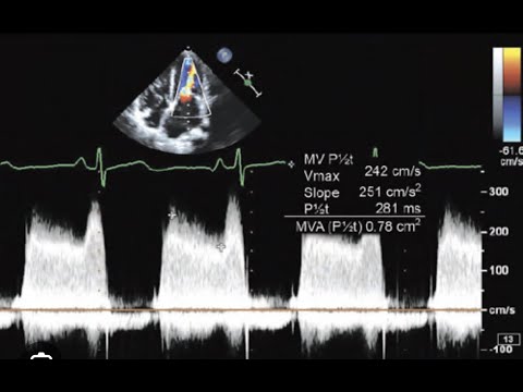 MS Quantifications, Pressure half time, PHT