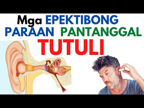 👂 Paano MATANGGAL ang TUTULI - Home Remedies at Gamot Pampatak | MATIGAS MALAMBOT  BARADONG TUTULI