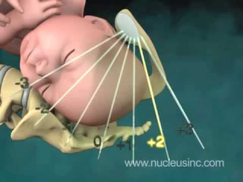 stránky doprovod vaginální stránky doprovod vaginální