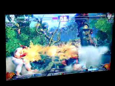 OHN7 SF4 Top 8 - ToXY (SA) vs Humanbomb (RY)