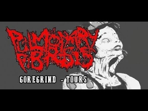 PULMONARY FIBROSIS  Live Paris Carnage Fest  2 27 01 2018