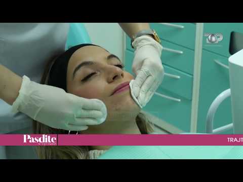 Pasdite ne TCH, Kiss Dent, 18 Janar 2018, Pjesa 4