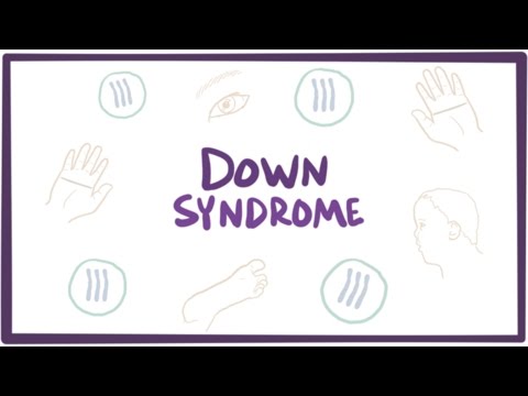 Ver vídeo Síndrome de Down (trisomía 21) - causas, síntomas, diagnóstico y patología.