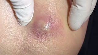 Ivvvv i feel bad for him